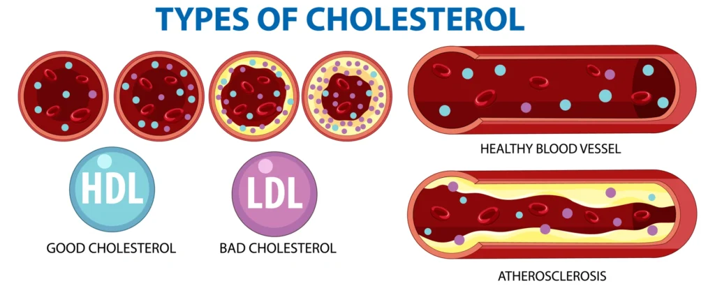 Ako znížiť cholesterol SportWell